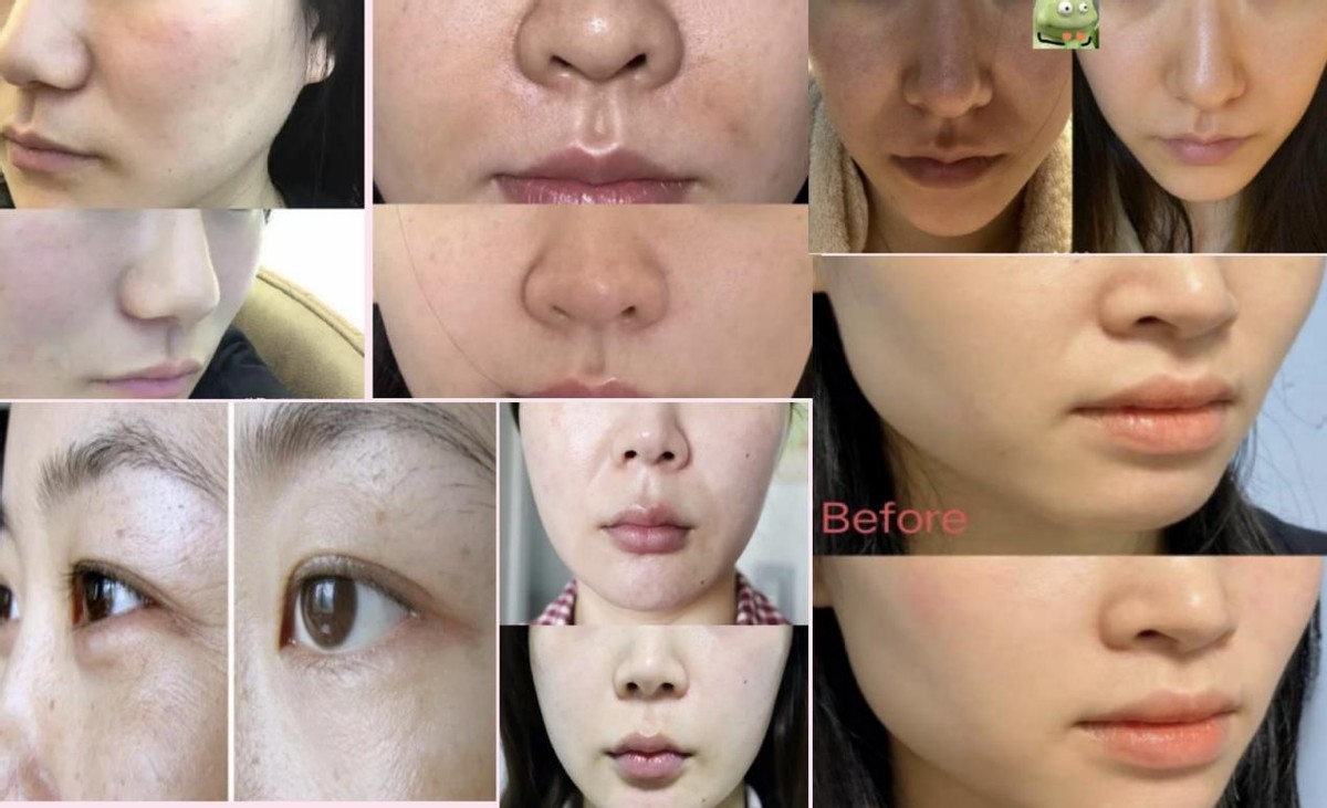 非专业抗皱产品危害_花王面霜怎么样_抗皱面霜弊端