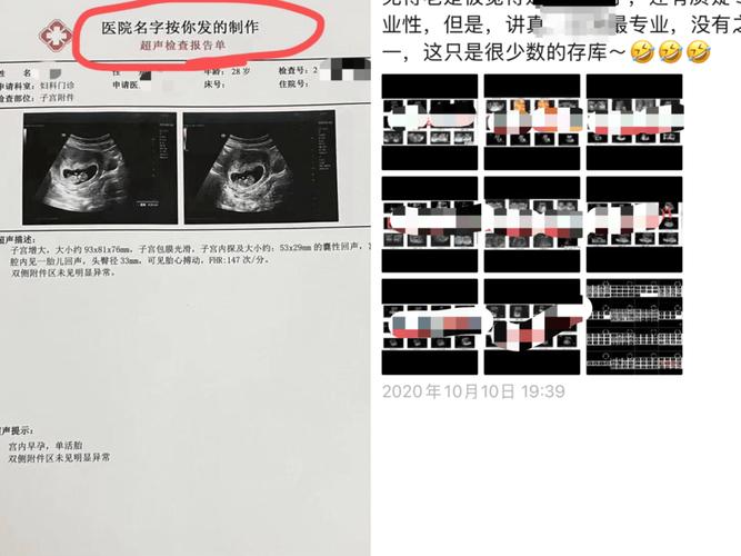 网购怀孕B超检查单_怀孕报告单生成器图片_假B超单定制