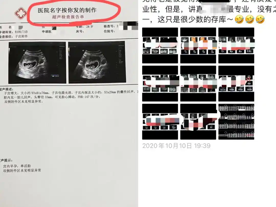 假B超单定制_怀孕报告单生成器图片_网购怀孕B超检查单